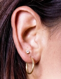ear surgery