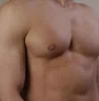 male plastic surgery male plastic surgery