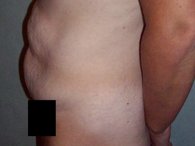 patient3 before3