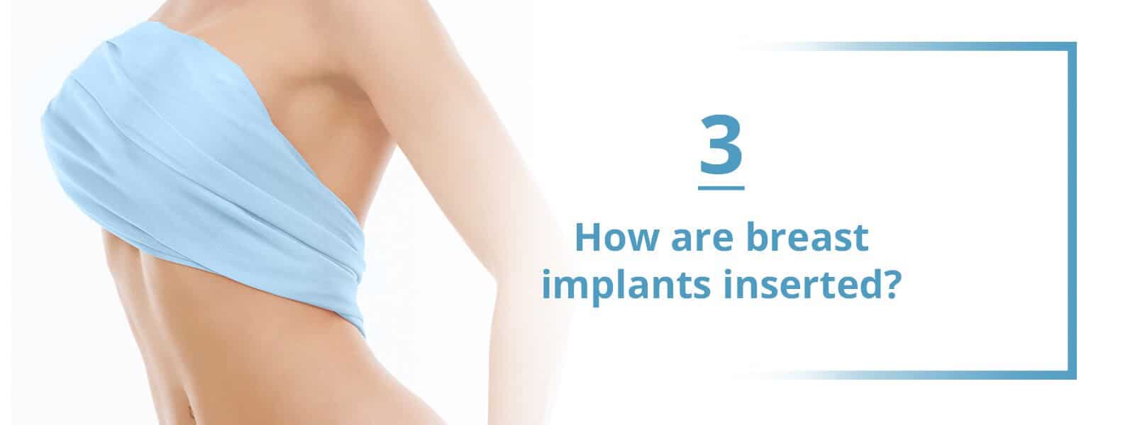 how are breast implants inserted?
