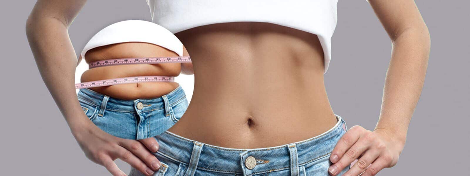 Lose Weight Before Surgery