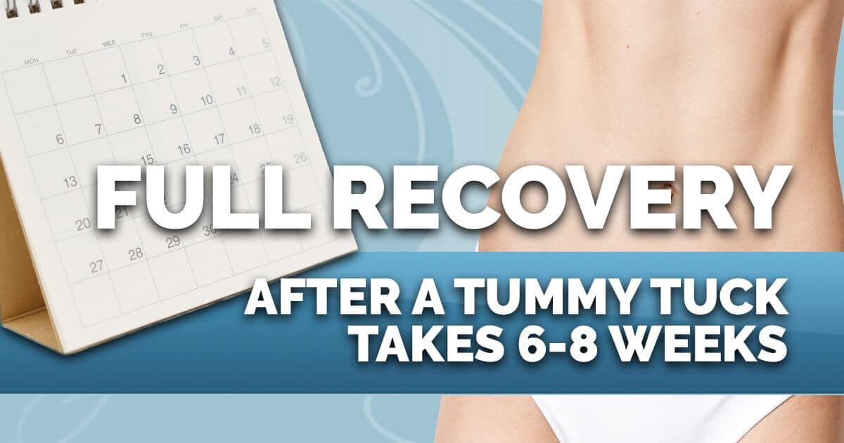 Tummy Tuck Full Recovery Takes 6-8 Weeks