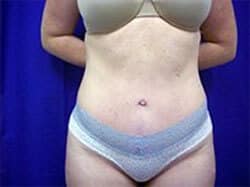 A woman wearing a gray bra and blue underwear showing her abdomen while keeping her arms at the back of her body.