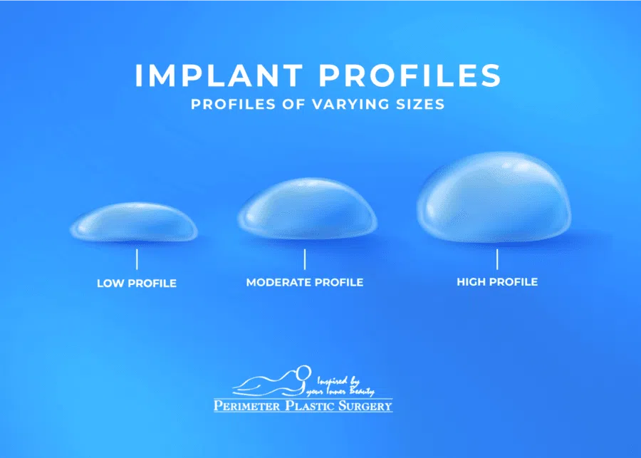 Implant profiles of varying sizes