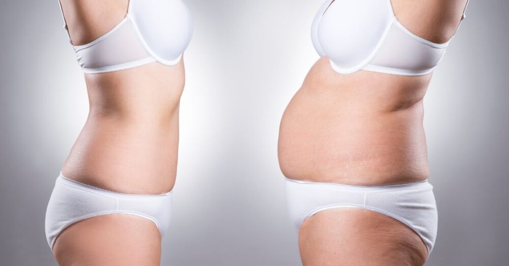 mommy make over before and after mommy make over before and after Atlanta Plastic Surgery - Top Doctor by Atlanta Magazine