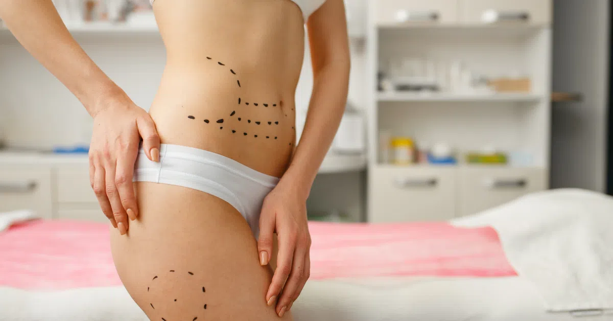 procedures in mommy makeover