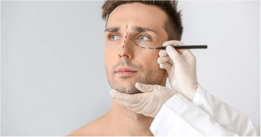 botox for men botox for men