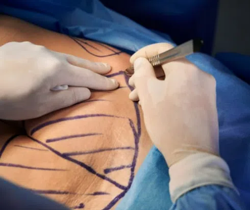 cosmetic surgery for men 1 cosmetic surgery for men