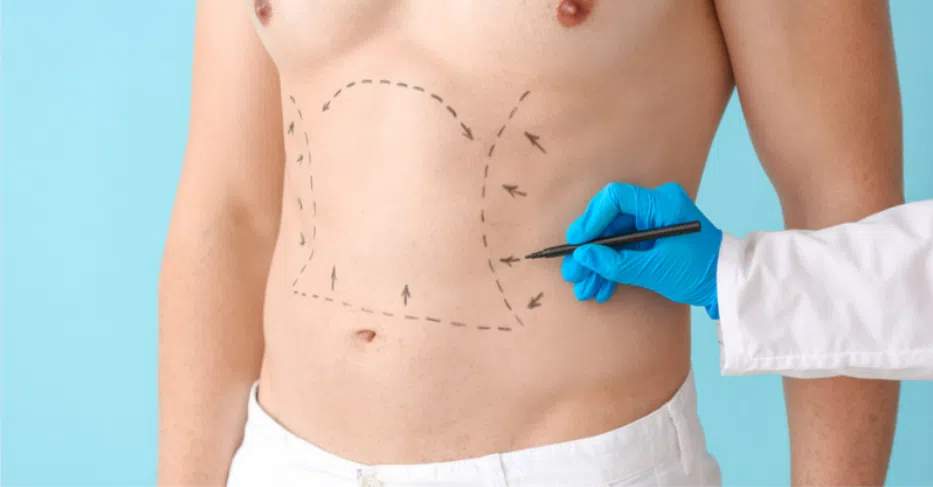 cosmetic surgery for men Plastic Surgery for Men in Atlanta