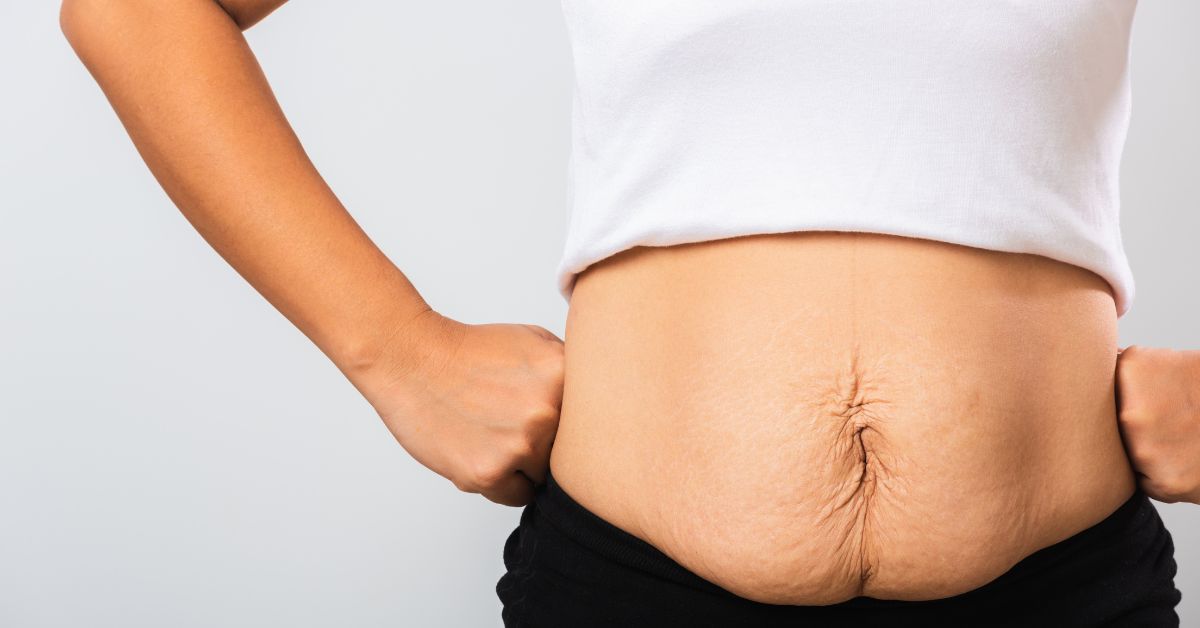 before tummy tuck surgery