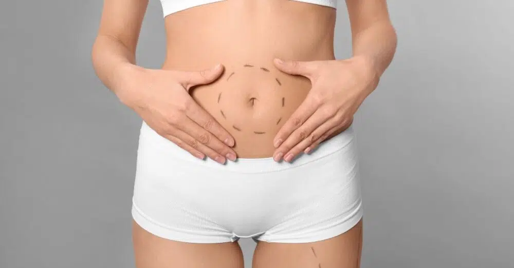 Atlanta Mommy Makeover Atlanta Plastic Surgery - Top Doctor by Atlanta Magazine