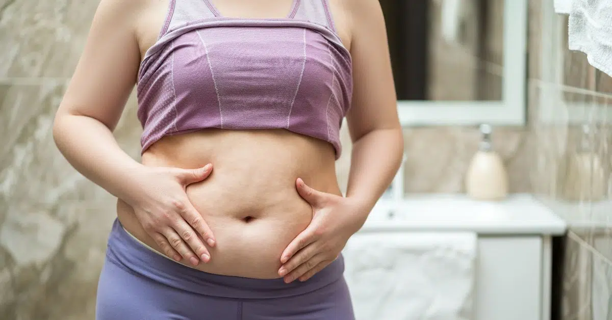 Woman considering a tummy tuck