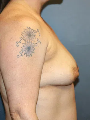 Atlanta Plastic Surgery - Top Doctor by Atlanta Magazine