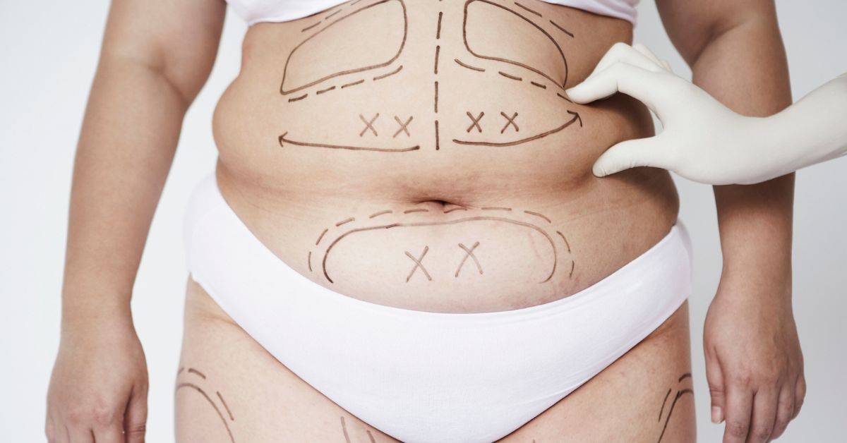 combined procedures preparing for surgical procedure